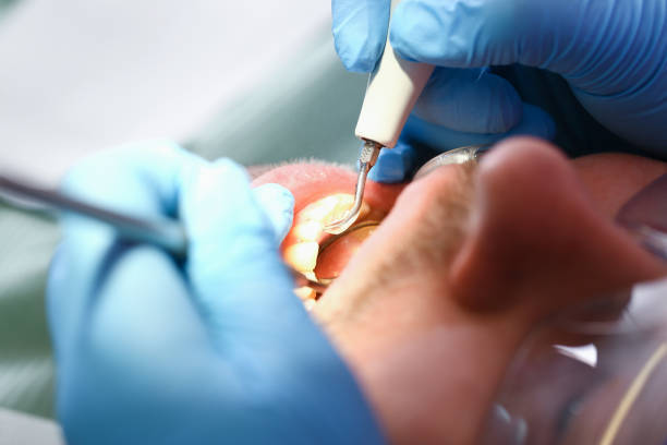 Best Emergency Dentist for Knocked-Out Tooth in Dexter, GA